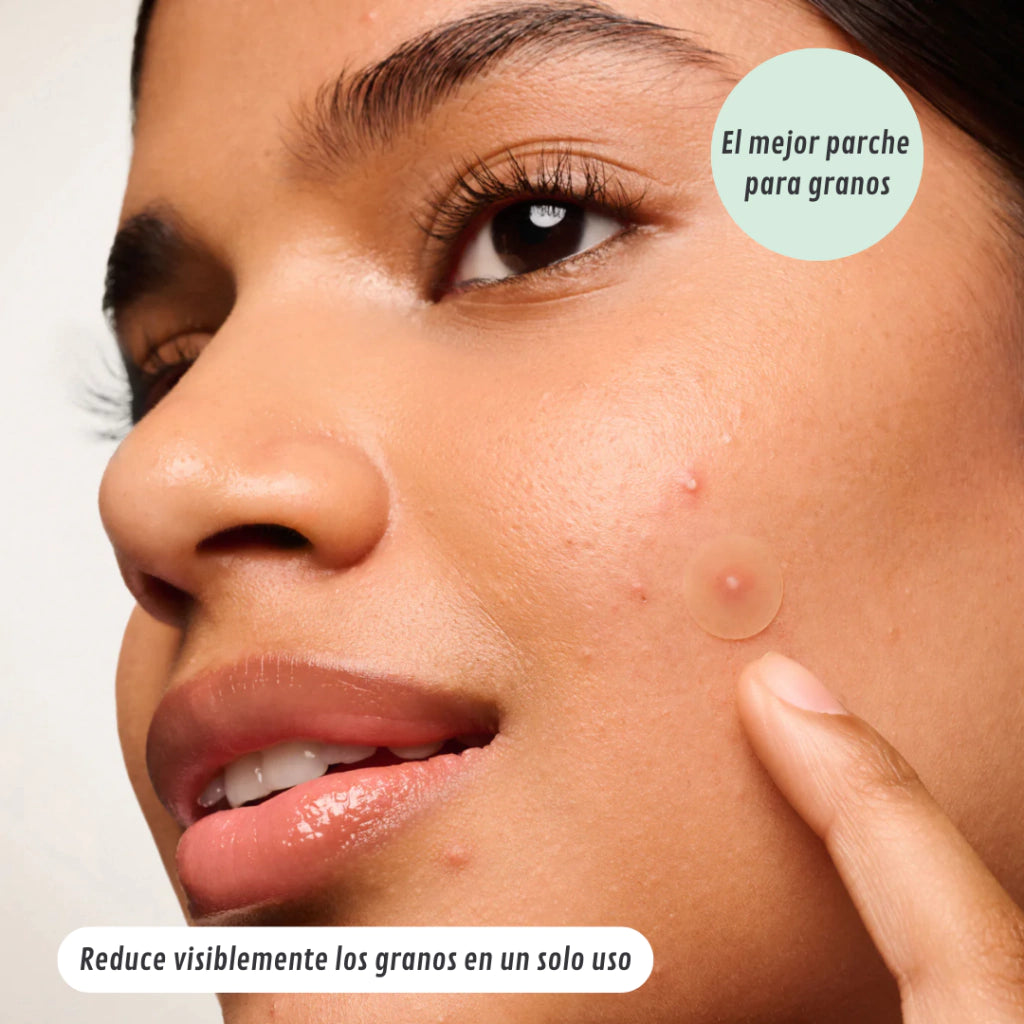 Clarivé™ - Parche Anti-Acne