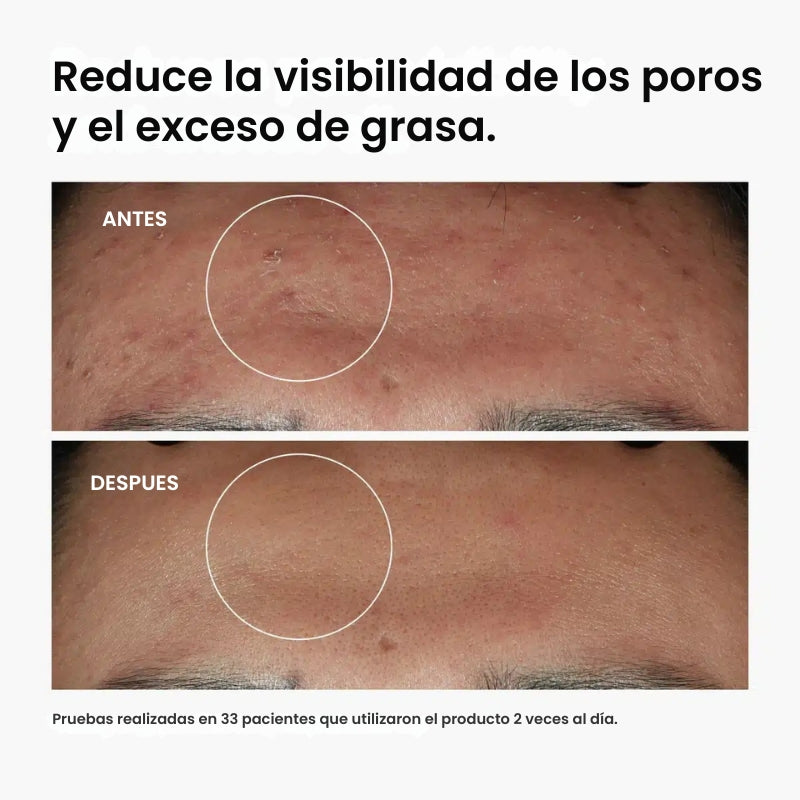 The Ordinary - Adiós granitos, hola seguridad.