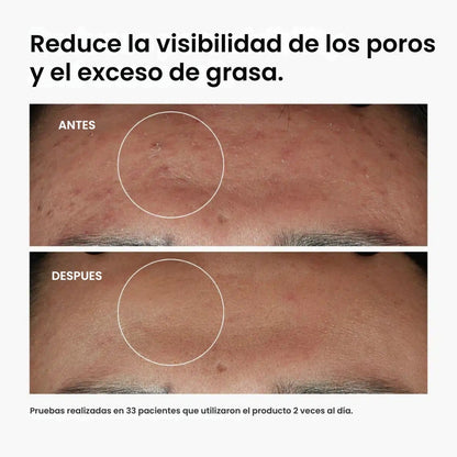 The Ordinary - Adiós granitos, hola seguridad.