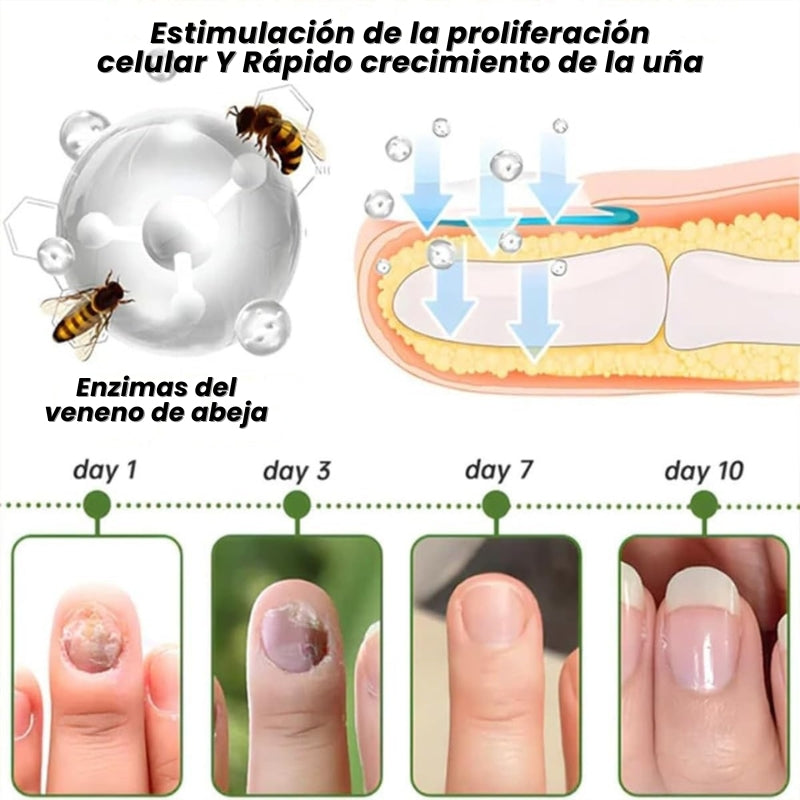VenomVital - Serum Para Hongos en las Uñas
