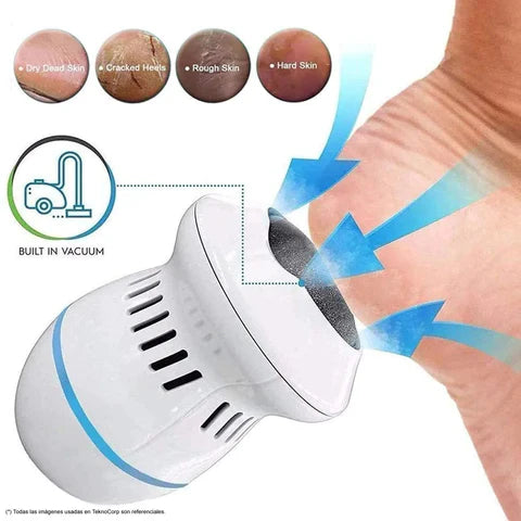 CleanFoot™ - Removedor Eléctrico de Callos