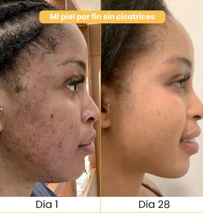 Jabón Cúrcuma - La solución natural contra las manchas