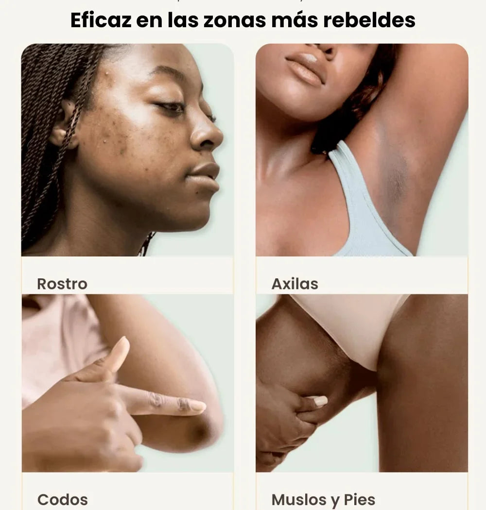 Jabón Cúrcuma - La solución natural contra las manchas
