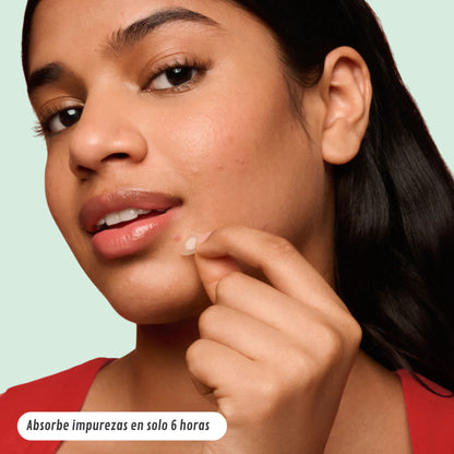 Clarivé™ - Parche Anti-Acne