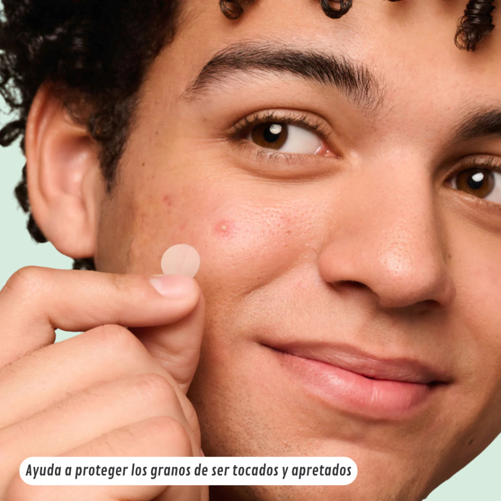 Clarivé™ - Parche Anti-Acne