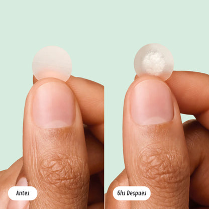 Clarivé™ - Parche Anti-Acne