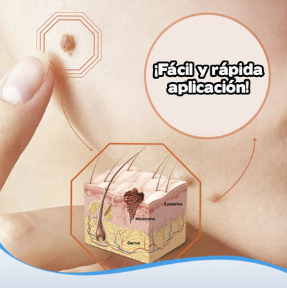 WartOff™ - Crema removedora de verrugas